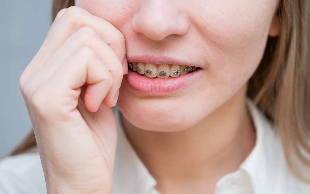 Woman with an orthodontic emergency in Ohio