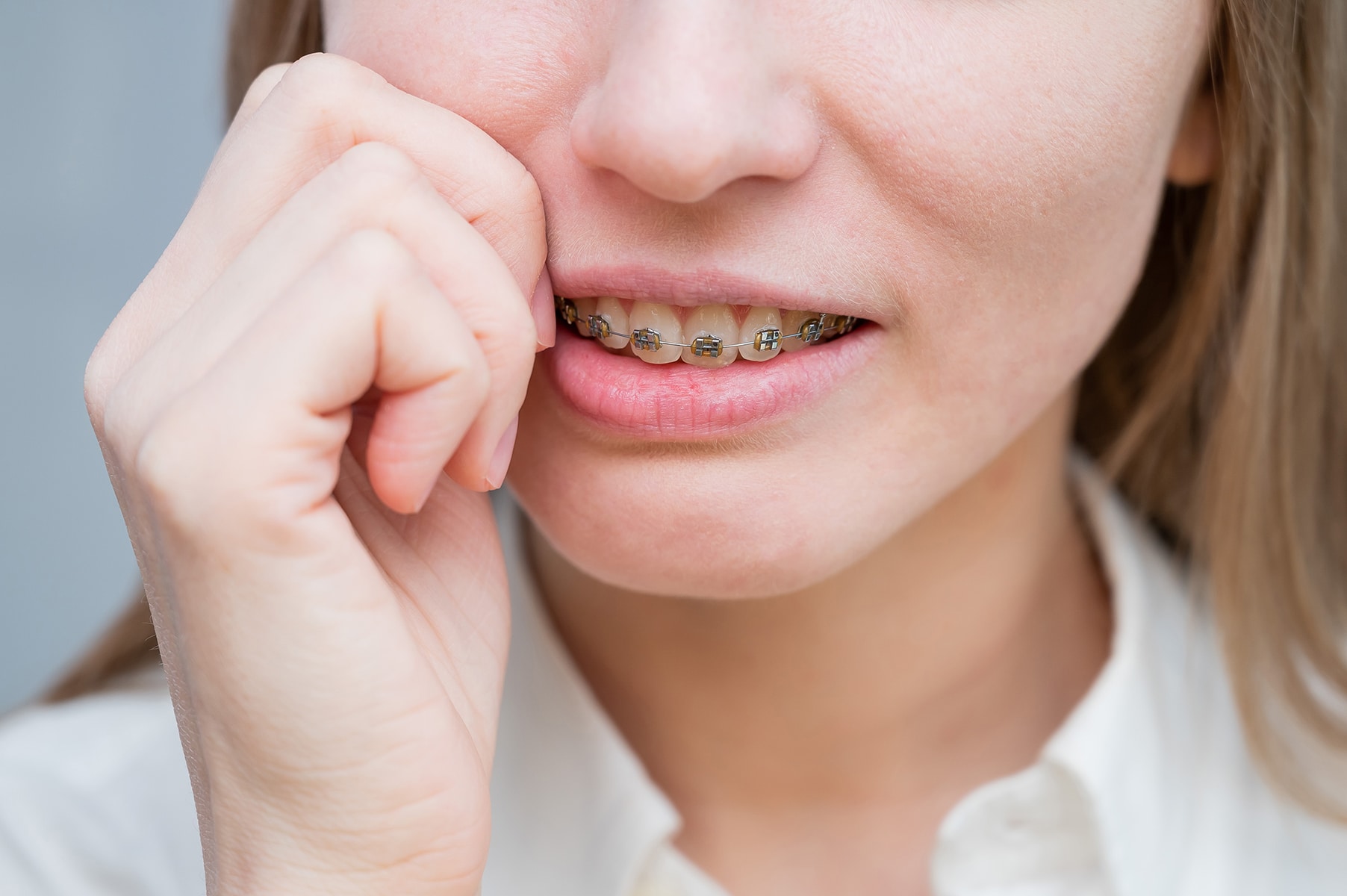 Woman with an orthodontic emergency in Ohio