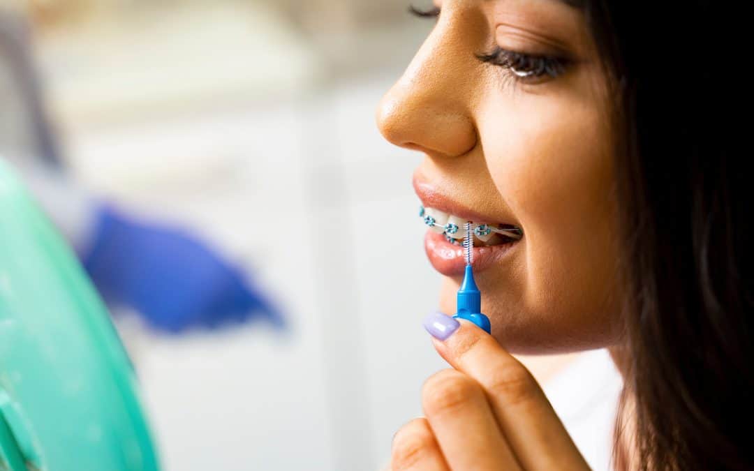 How to Take Care of Your Teeth During Orthodontic Treatment