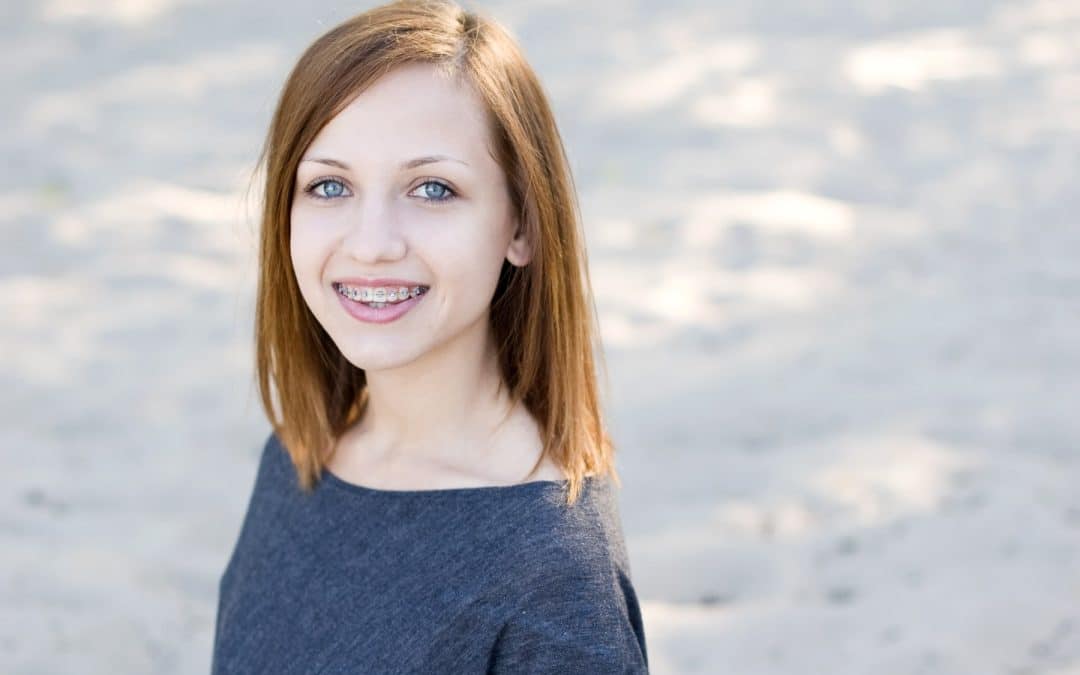 Getting Braces a Second Time: Is It Common?